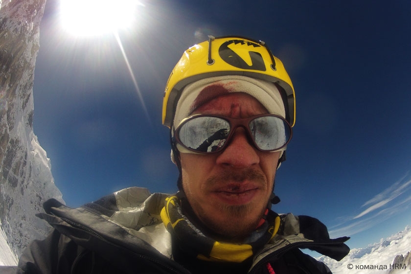 Разбитый лоб Ивана Дождева Разбитый лоб Ивана Дождева